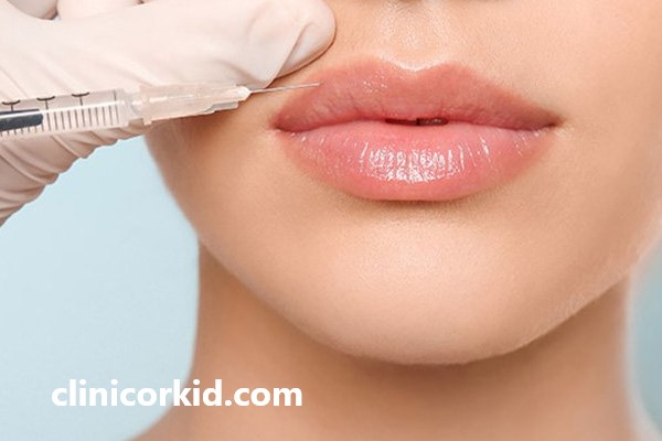 بهترین کلینیک برای تزریق فیلر لب | کلینیک ارکید