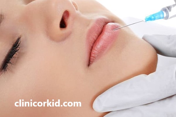 آشنایی با مراقبت های بعد از تزریق فیلر لب | کلینیک ارکید