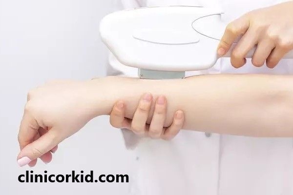 لیزر موهای زائد در زمان بارداری | کلینیک ارکید