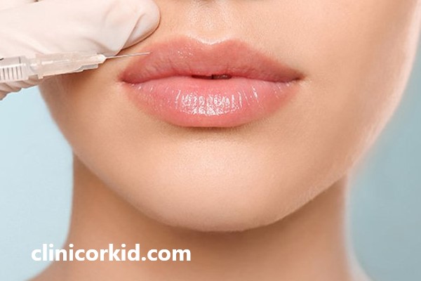 تفاوت فیلر لب و ژل لب چیست؟ | کلینیک ارکید