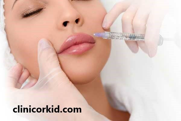 فیلر لب مدل روسی چگونه است؟ | کلینیک ارکید