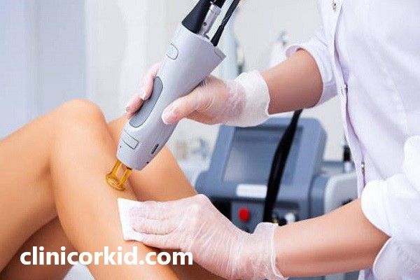 لیزر موهای زائد با بهترین دستگاه | کلینیک ارکید