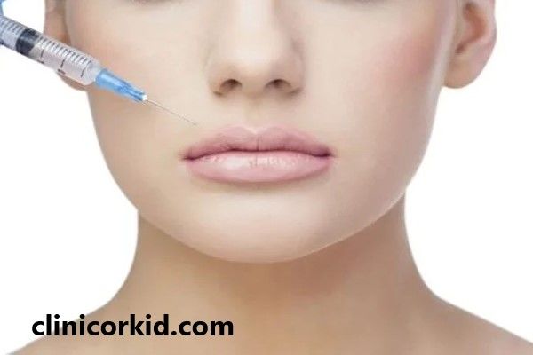 تزریق ژل برای رفع خط خنده | کلینیک ارکید
