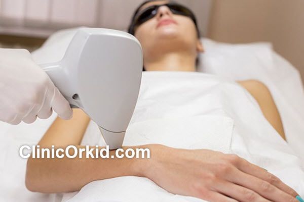 مراقبتهای قبل از لیزر موهای کرکی | کلینیک ارکید