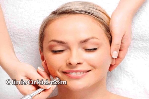 مزایای میکرودرم کدام است؟ | کلینیک ارکید