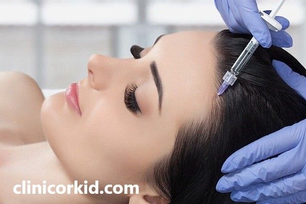 مزوتراپی مو با استفاده از بهترین متریال | کلینیک ارکید