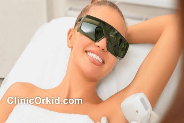 چه عواملی بر ماندگاری لیزر موهای زائد موثر است؟ | کلینیک ارکید