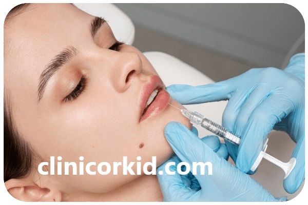 مدت زمان ماندگاری تزریق فیلر | کلینیک ارکید