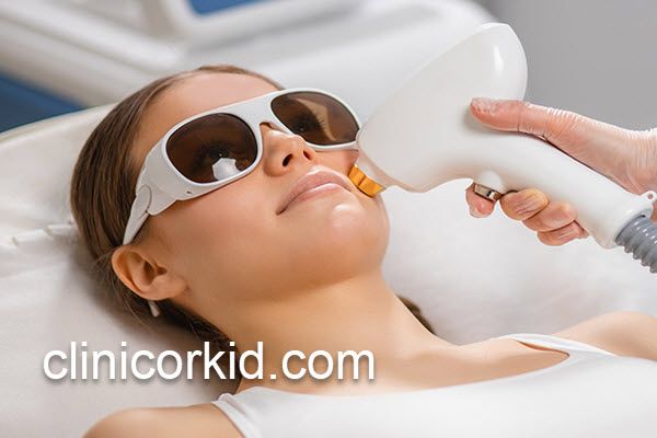 رفع موهای زائد پشت لب در کلینیک تخصصی | کلینیک ارکید