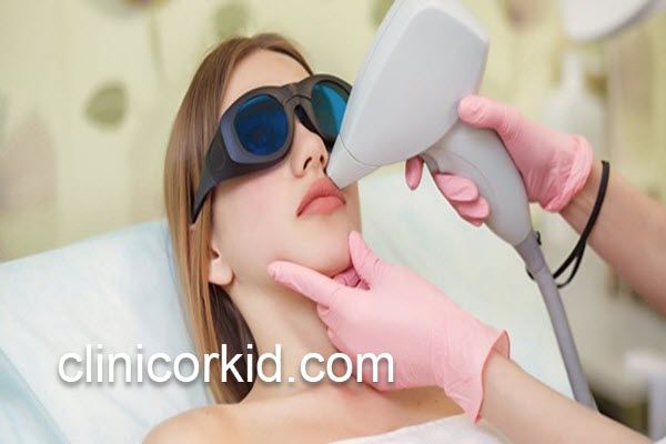 از بین بردن موهای زائد پشت لب در غرب تهران | کلینیک ارکید