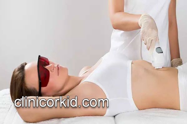 لیزر موهای زائد شکم در کلینیک معتبر | کلینیک ارکید