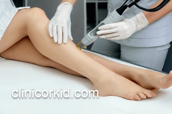 لیزر موهای زائد کل بدن چند جلسه است؟ | کلینیک ارکید