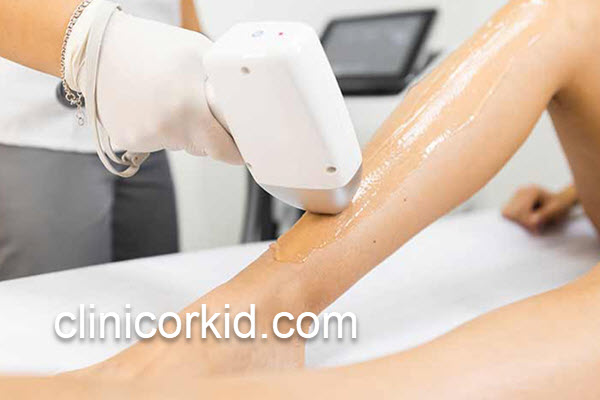 اطلاعات لازم درباره لیزر موهای زائد | کلینیک ارکید