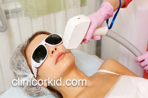 نکات مهم درباره لیزر موهای زائد | کلینیک ارکید