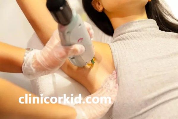 بهترین کلینیک لیزر برای موهای نازک | کلینیک ارکید