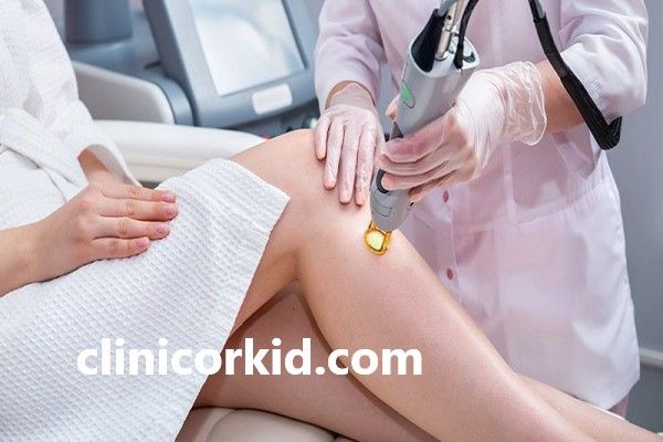 دستگاه مناسب برای رفع موهای نازک و کرکی | کلینیک ارکید