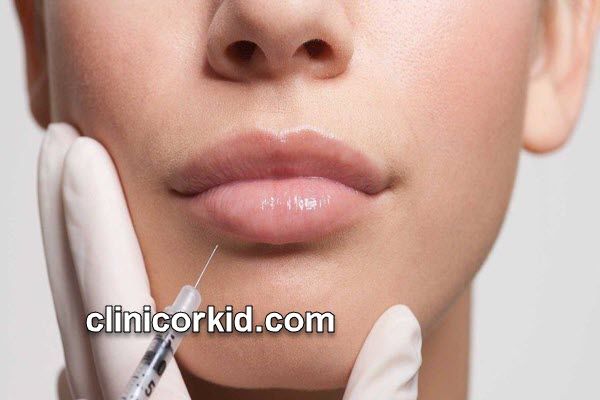 هزینه تزریق فیلر به صورت در سال ۱۴۰۳ چقدر است؟