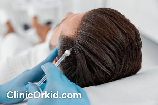 بهترین مرکز مزوتراپی مو در غرب تهران | کلینیک ارکید