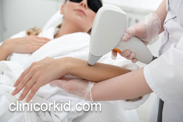 بهترین دستگاه برای لیزر موهای زائد کدام است؟ | کلینیک ارکید