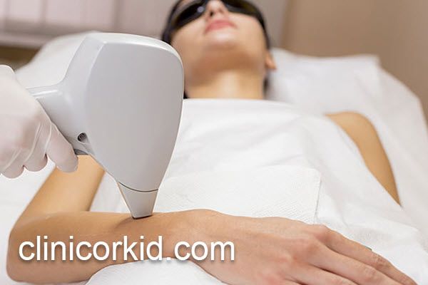 دستگاه لیزر پیشرفته برای لیزر موهای زائد | کلینیک ارکید