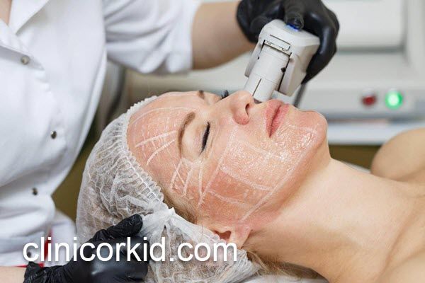 بهترین کلینیک هایفوتراپی صورت با کادر مجرب | کلینیک ارکید