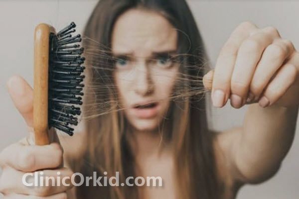 ریزش مو یعنی چه؟