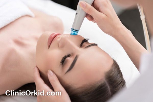 میکرودرمی چیست؟ | کلینیک ارکید