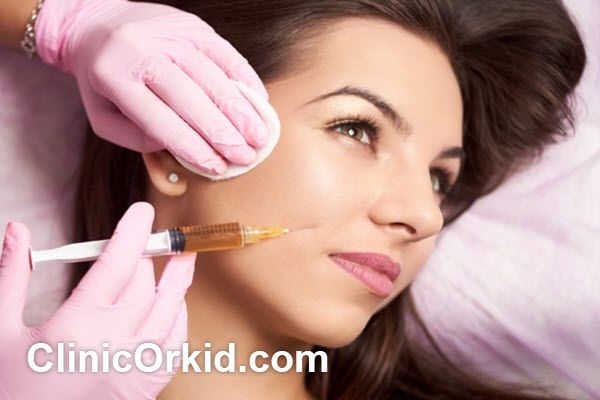 هزینه تزریق فیلر خط خنده چقدر است؟ | کلینیک ارکید