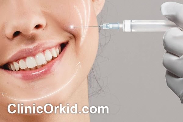 مزایای تزریق فیلر خط خنده | کلینیک ارکید
