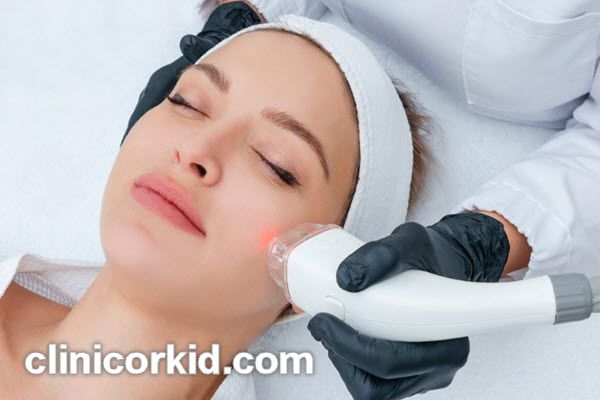 عوامل موثر بر هزینه لیزر جای جوش | کلینیک ارکید