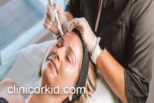 بررسی هزینه های میکرونیدلینگ در سال 1403 | کلینیک ارکید