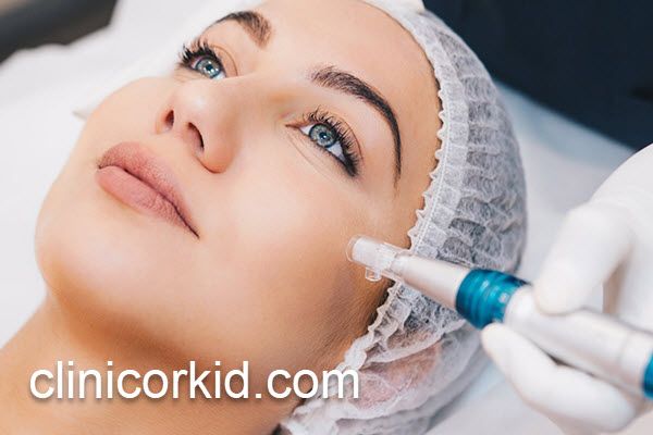هزینه های میکرونیدلینگ در کلینیک غرب تهران | کلینیک ارکید