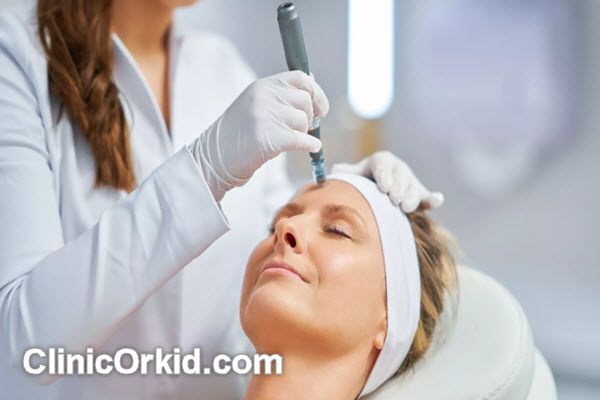 جلسات مورد نیاز برای انجام میکرونیدلینگ | کلینیک ارکید
