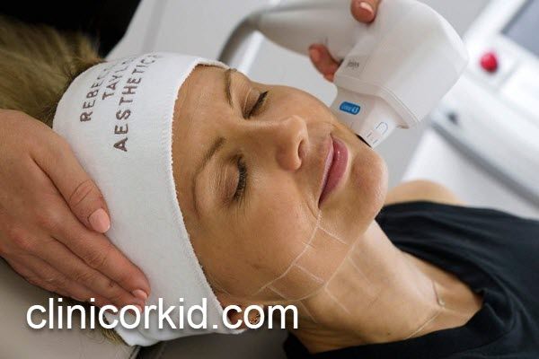 بررسی ماندگاری نتایج هایفوتراپی صورت | کلینیک ارکید