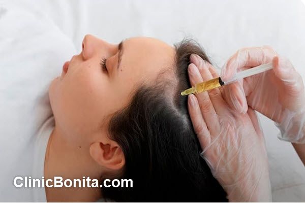 مزایای مزوتراپی مو | کلینیک ارکید
