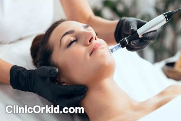 عوامل موثر بر قیمت میکرونیدلینگ | کلینیک ارکید