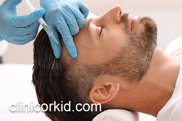 قیمت 10 جلسه مزوتراپی مو | کلینیک ارکید