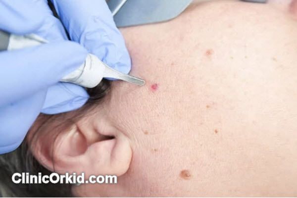 دوره نقاهت و مراقبتهای پس از عمل | کلینیک ارکید