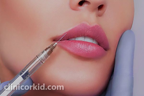 ژل لب چیست؟ | غرب تهران