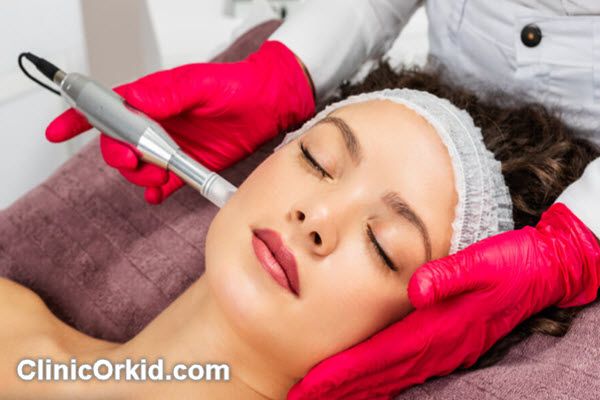 تاثیر میکرونیدلینگ بعد از چند روز است؟ | کلینیک ارکید
