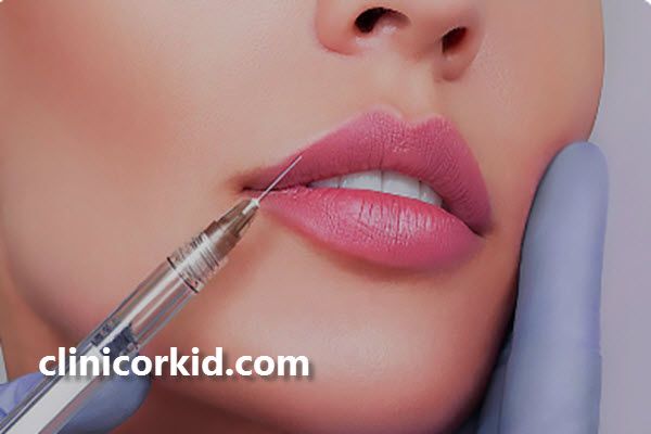 مزایای استفاده از ژل لب