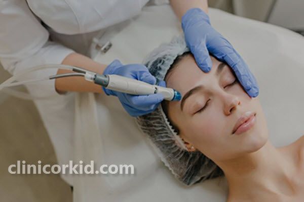 مزوتراپی صورت چیست؟