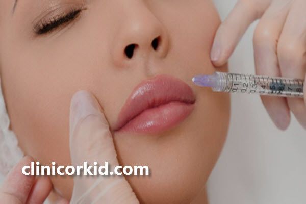چگونه ماندگاری ژل لب را افزایش دهیم؟