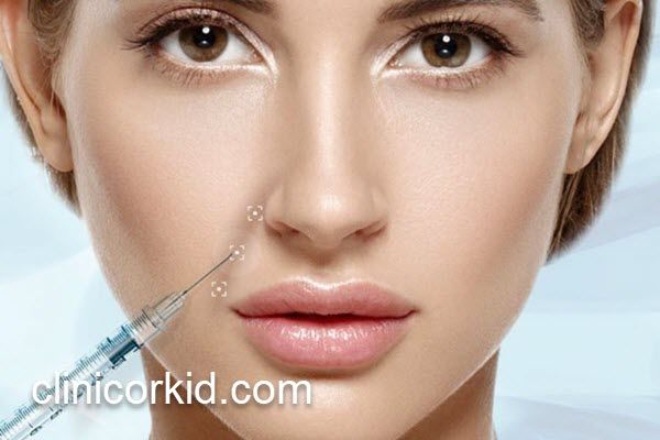 مراقبت های بعد از تزریق ژل خط خنده | کلینیک ارکید