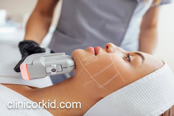جلسات لازم برای هایفوتراپی صورت | کلینیک ارکید