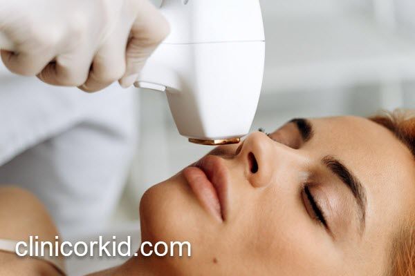 قیمت لیزر موهای زائد در 1404 | کلینیک ارکید