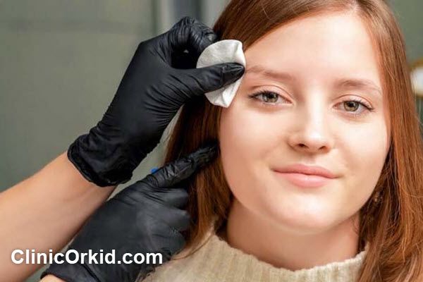 چرا لیزر کیوسوئیچ یک انتخاب مناسب برای حذف تتو است؟ | کلینیک ارکید