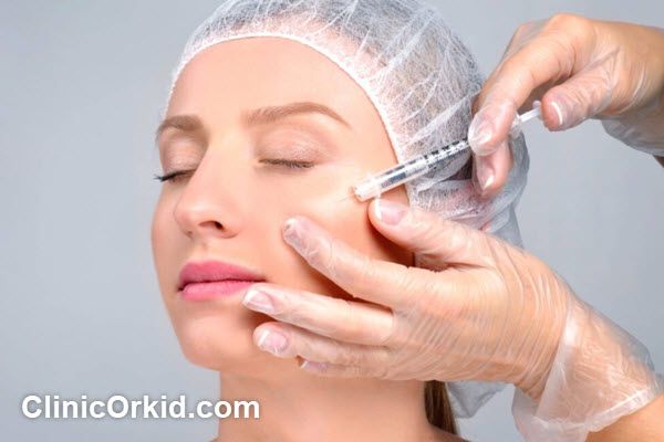 ویژگی بهترین دکتر تزریق ژل گونه طبیعی در غرب تهران | کلینیک ارکید