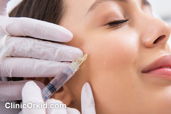 هزینه تزریق ژل توسط بهترین دکتر تزریق ژل تهران | کلینیک ارکید