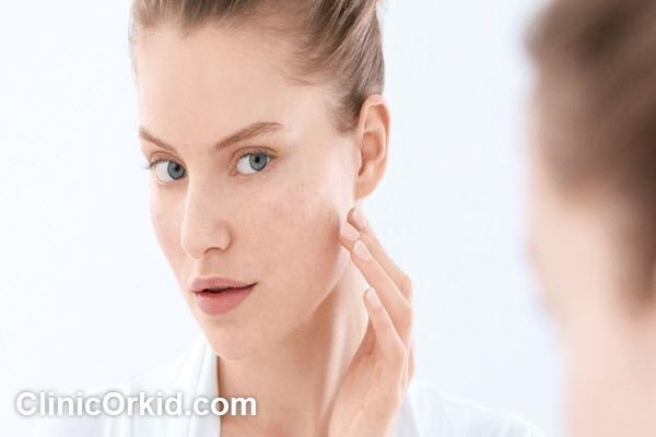 نوسانات قیمت لیزر صورت | کلینیک ارکید
